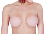 Breast Lift Silicone